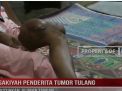 SAKIYAH PENDERITA TUMOR TULANG BUTUHKAN ULURAN TANGAN