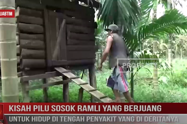 KISAH PILU SOSOK RAMLI YANG BERJUANG UNTUK HIDUP DI TENGAH PENYAKIT YANG DI DERITANYA