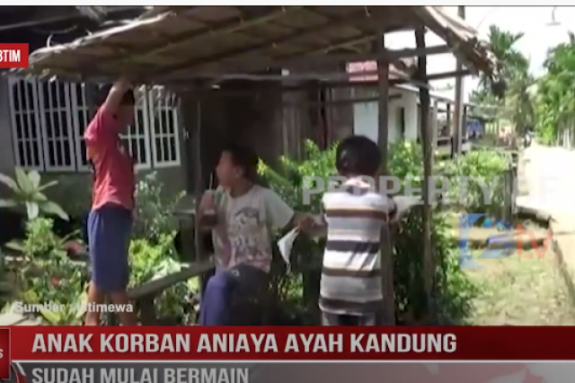 ANAK KORBAN ANIAYA AYAH KANDUNG SUDAH MULAI BERMAIN